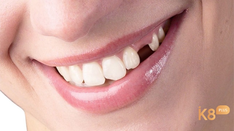 Giấc mơ thấy rụng răng có ý nghĩa liên quan đến sự cứng cáp cùng ý nghĩa và tài lộc