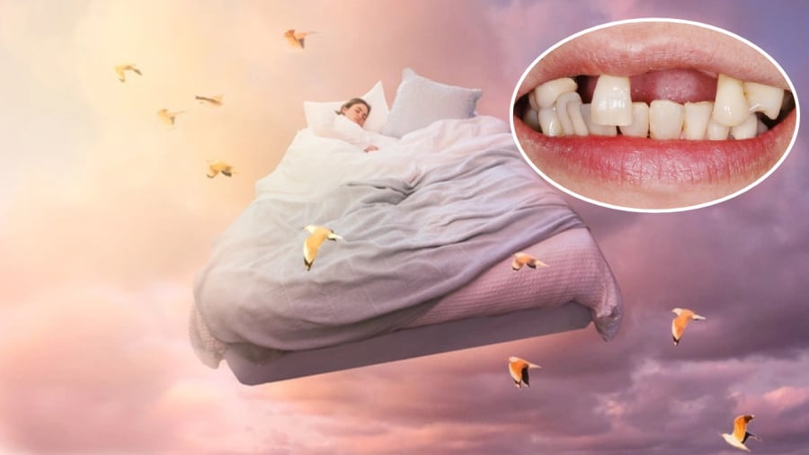 Giải mã giấc mơ thấy rụng răng: Điềm báo và con số may mắn